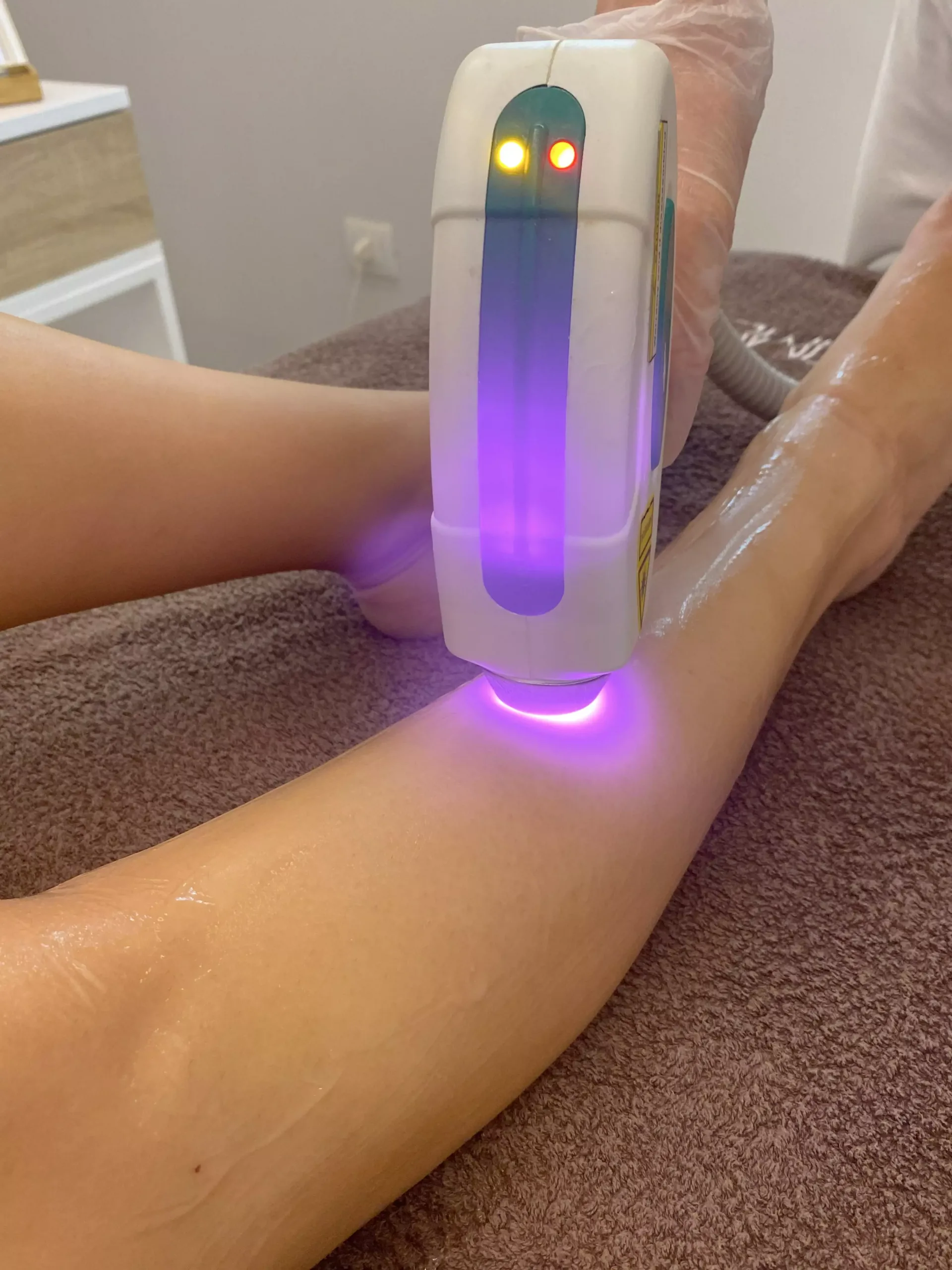Epilazione laser - Hintime Point Marilyn